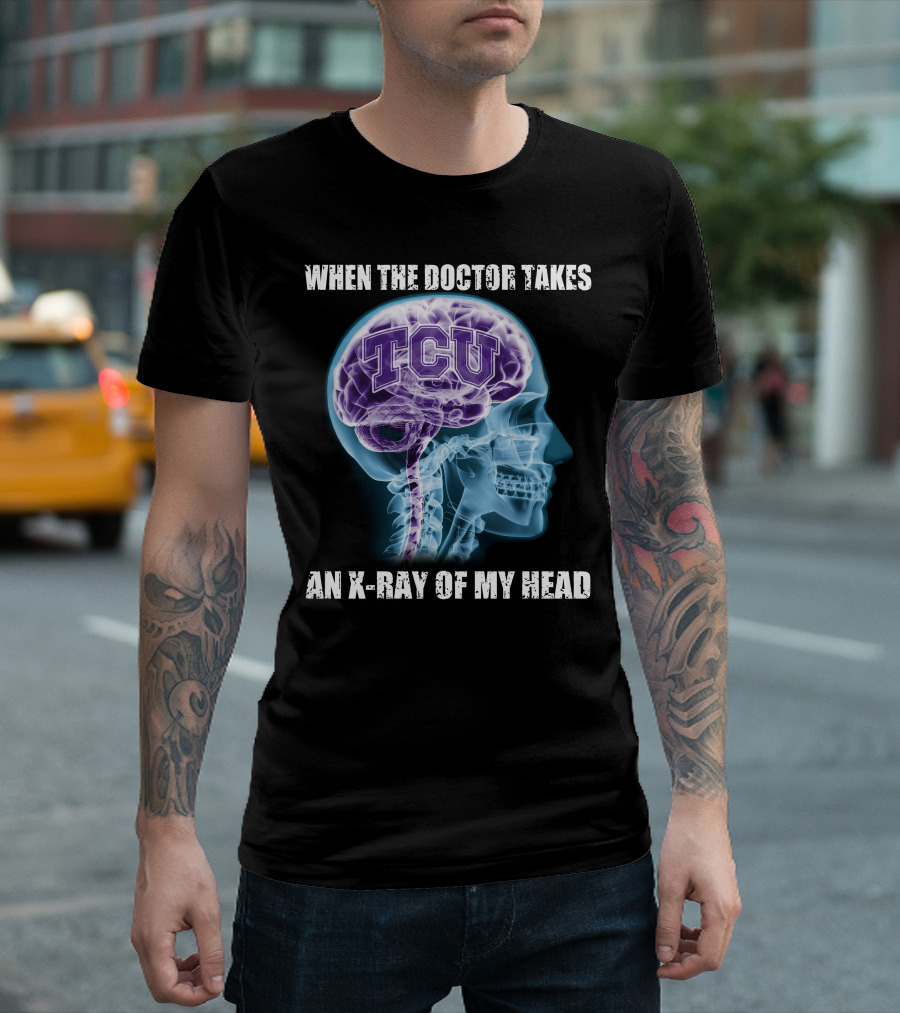 TCU Horned Frogs When The Doctor Takes An X-ray Of My Head T-Shirt