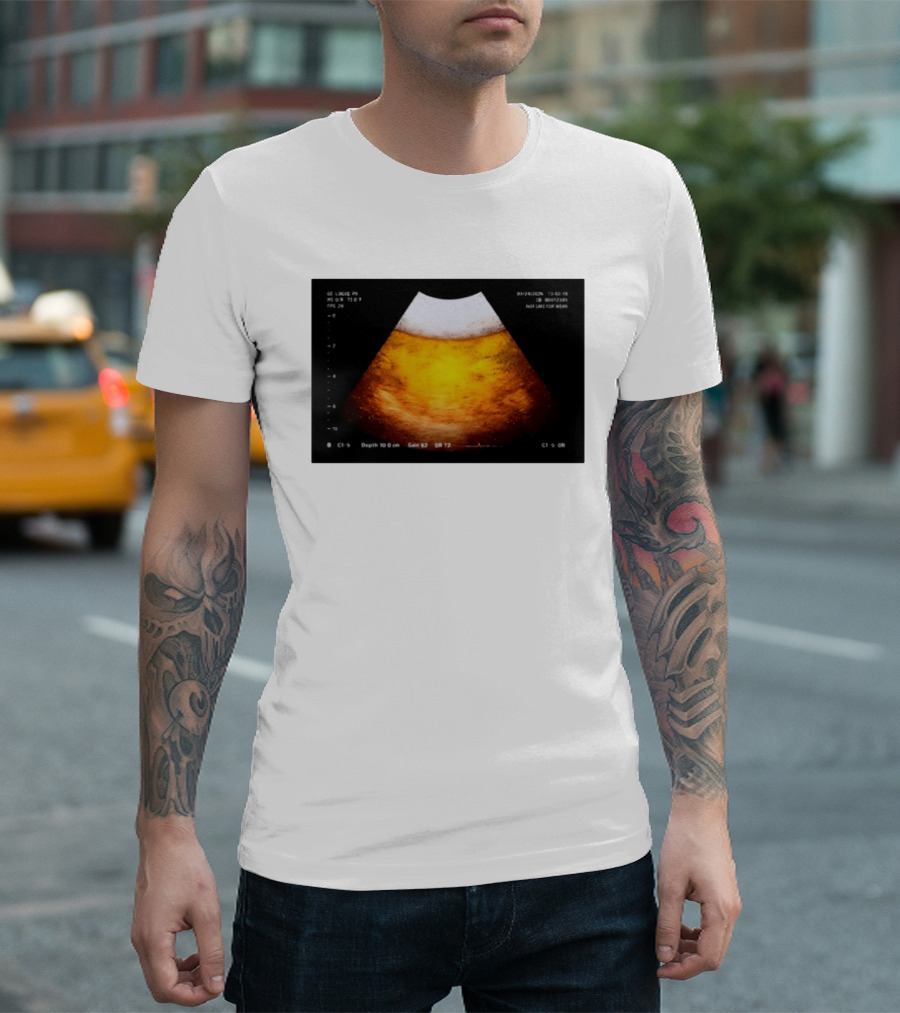 Beer Ultrasound Image Not Safe For Liver T-Shirt
