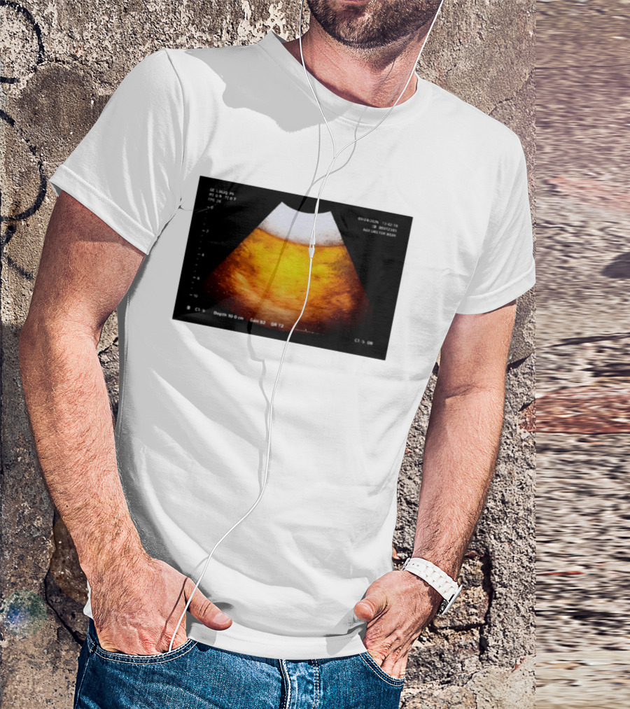 Beer Ultrasound Image Not Safe For Liver T-Shirt