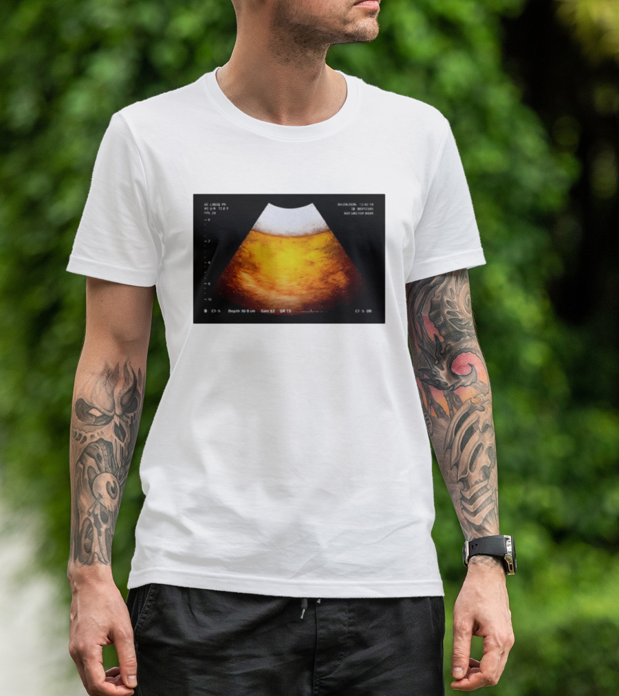 Beer Ultrasound Image Not Safe For Liver T-Shirt