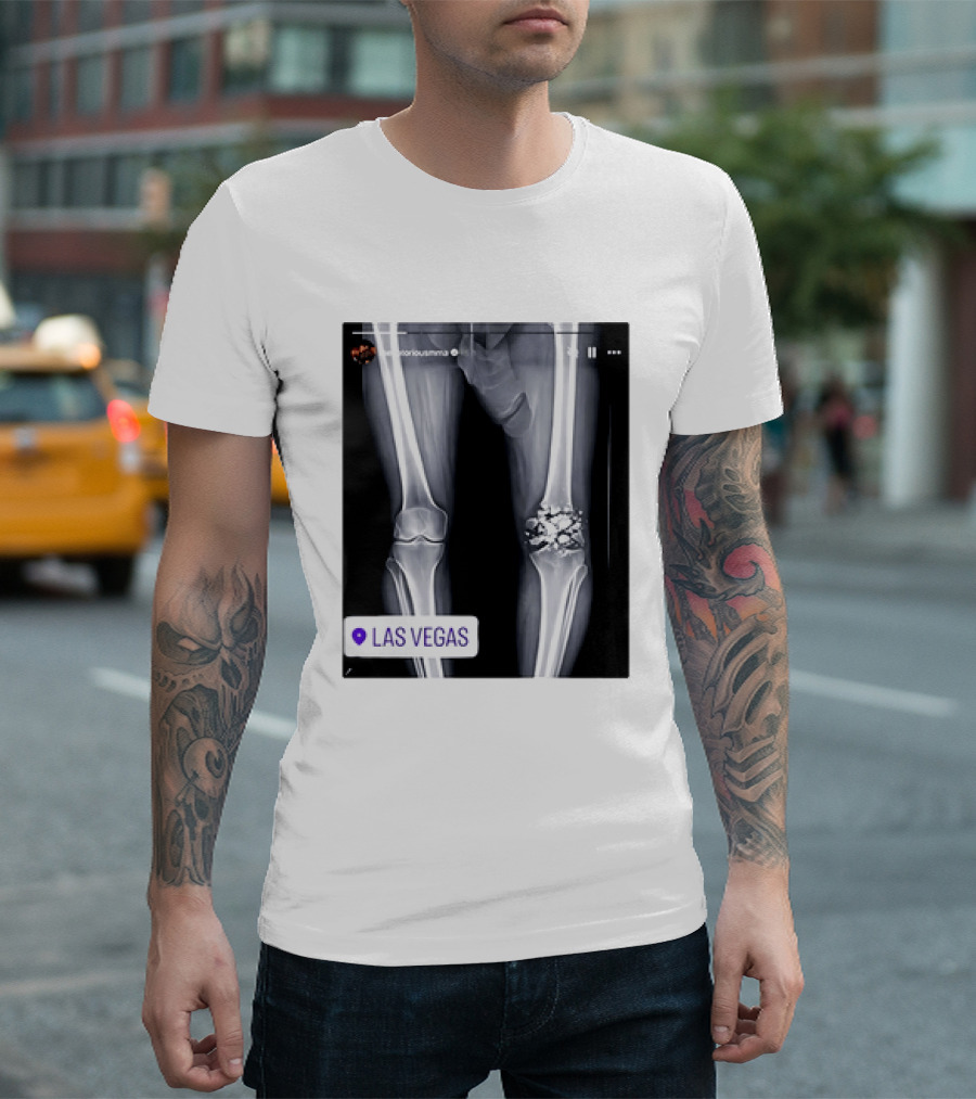 Conor McGregor X Ray Broken Knee Las Vegas T-Shirt