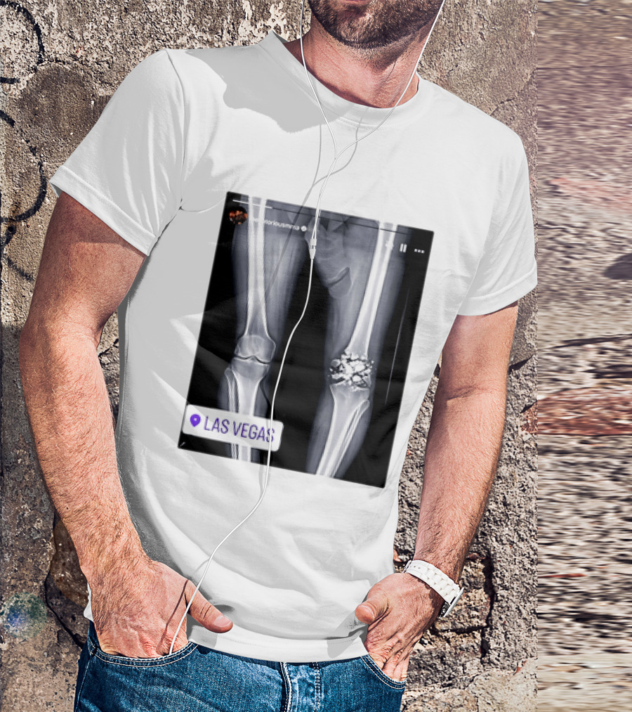 Conor McGregor X Ray Broken Knee Las Vegas T-Shirt